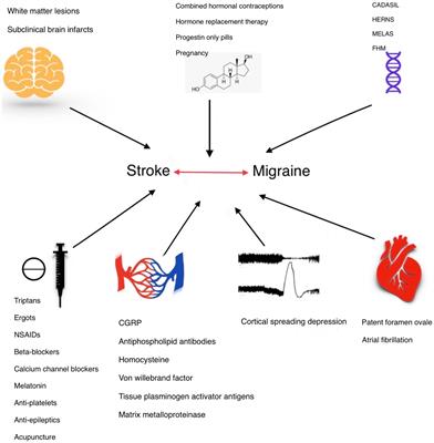 Reviewing migraine-associated pathophysiology and its impact on elevated stroke risk